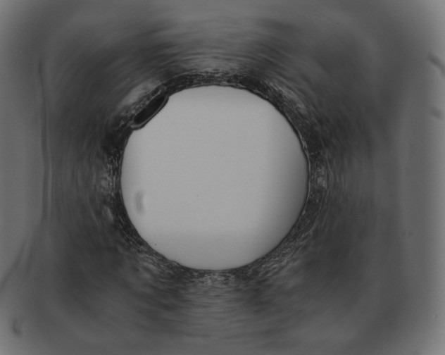 X0000091520869200709071014