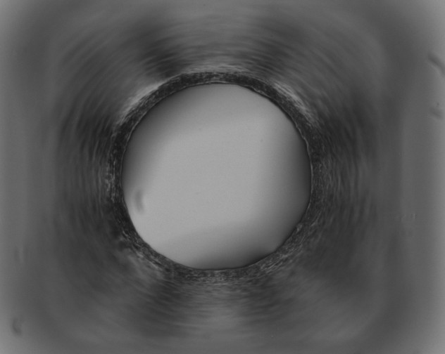 X0000091520872200709071014