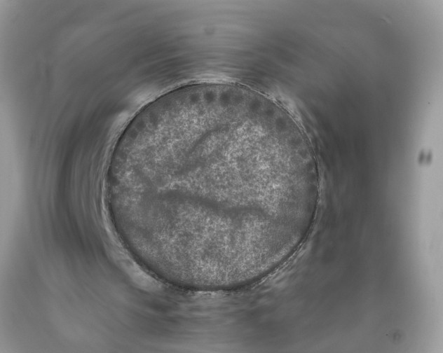 X0000091520145200709141421