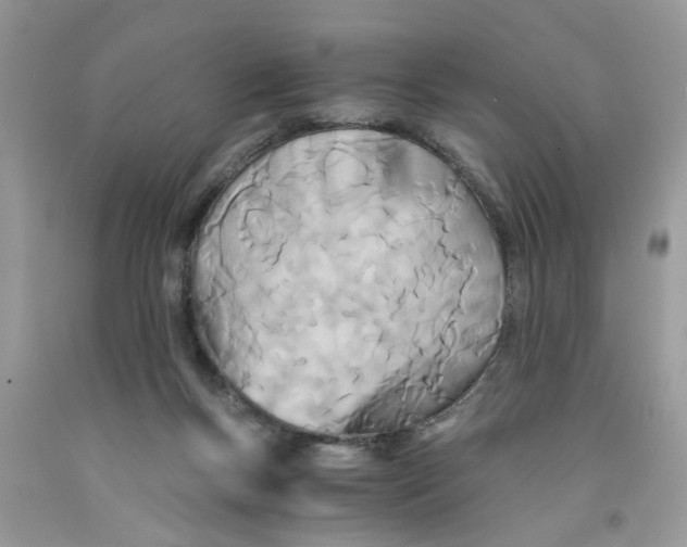 X0000091520167200709141422