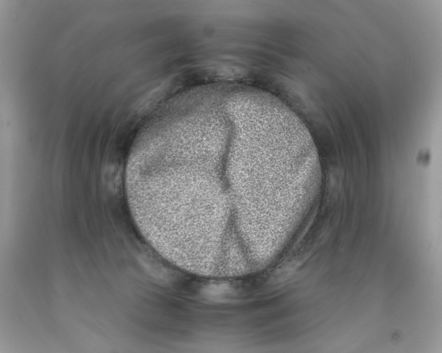 X0000091520177200709141422