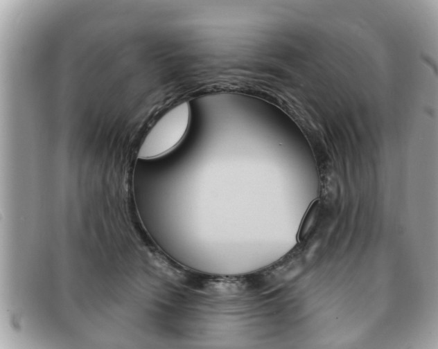 X0000091530466200708170953