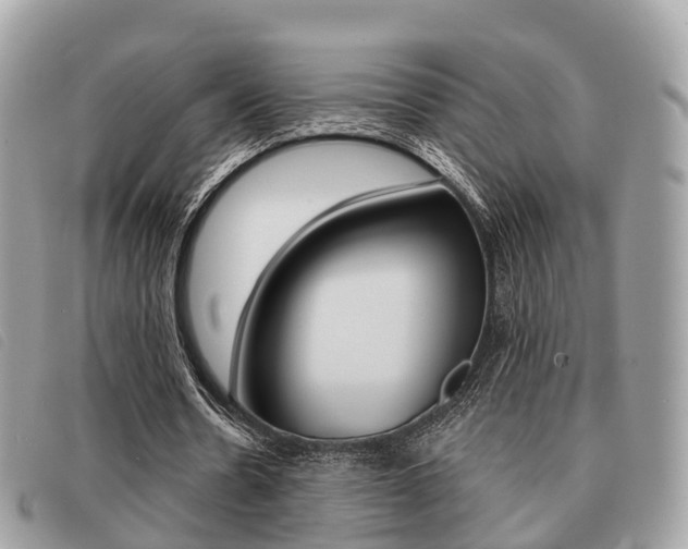 X0000091530530200708170952