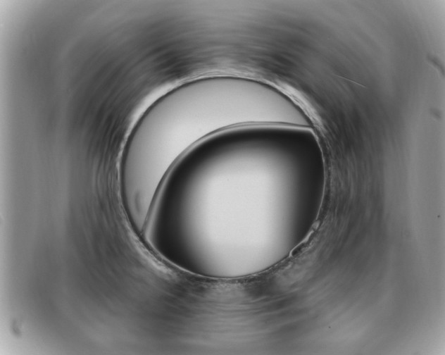 X0000091531238200708170943