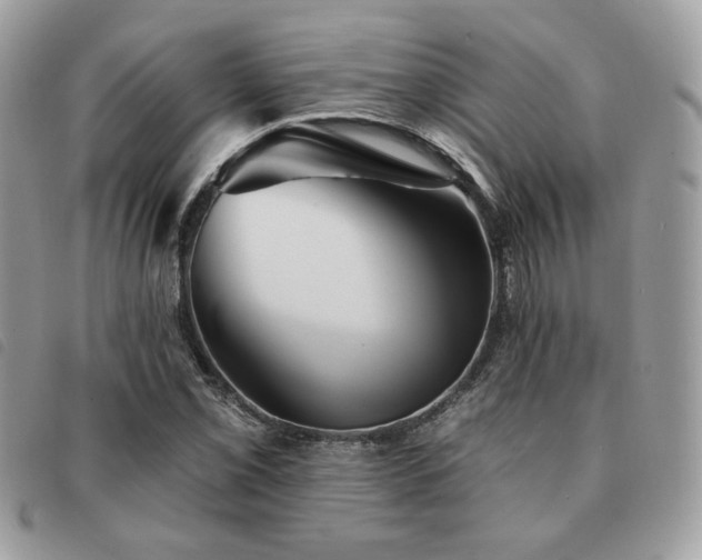 X0000091531069200708171215