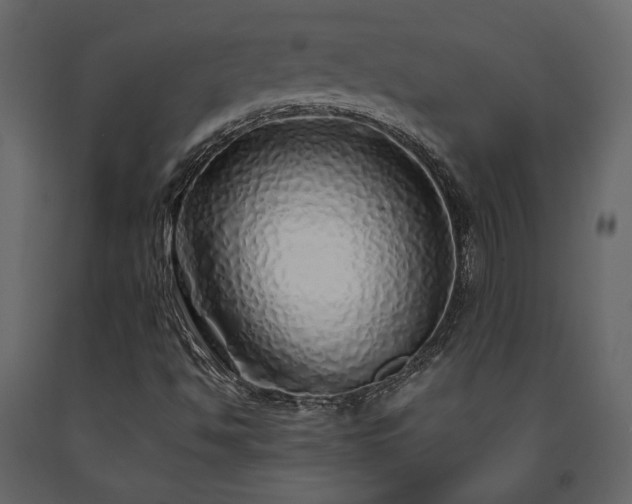 X0000091531494200708241700