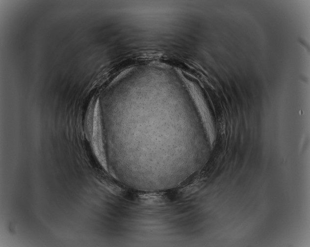 X0000091530516200709071044