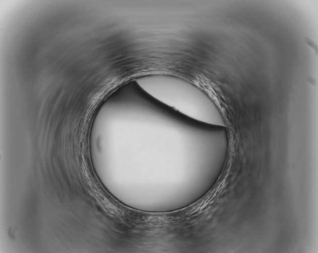 X0000091540145200708171017