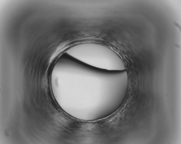 X0000091540198200708171017