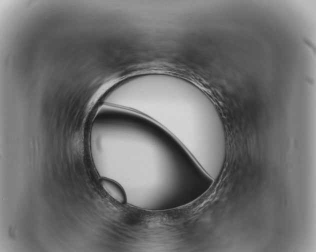 X0000091540200200708171017