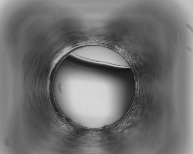 X0000091540292200708171015