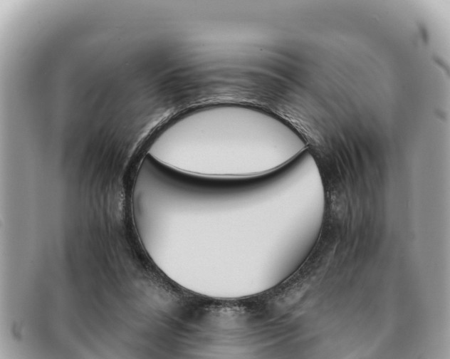 X0000091540304200708171015