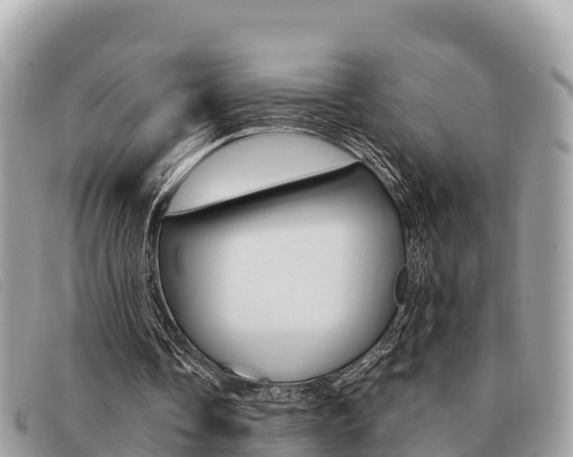 X0000091540338200708171014