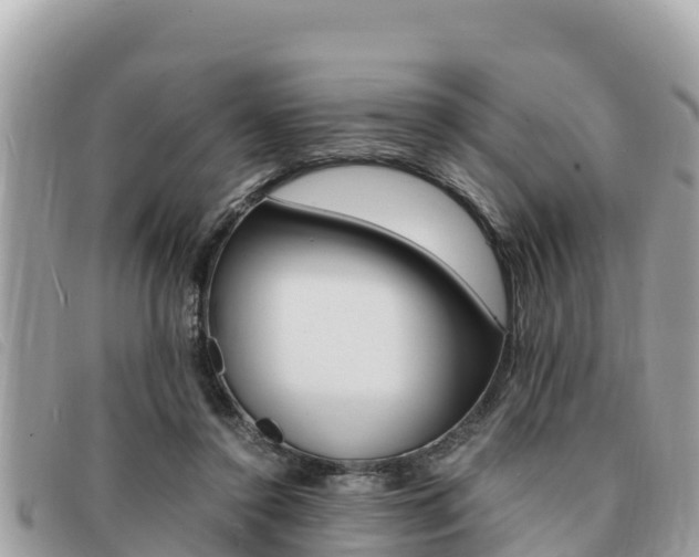 X0000091540356200708171014