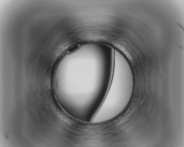 X0000091540399200708171014