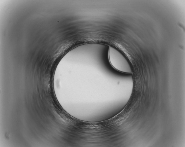 X0000091540443200708171013