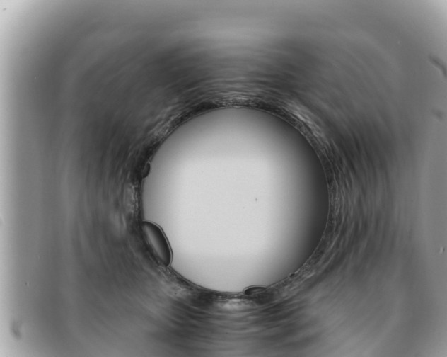 X0000091540467200708171013