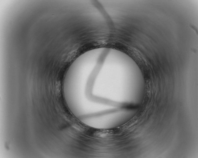 X0000091540563200708171012