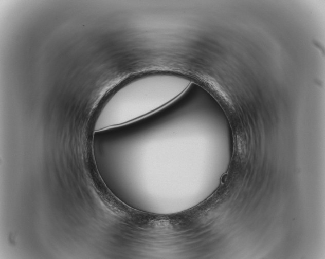 X0000091540588200708171011