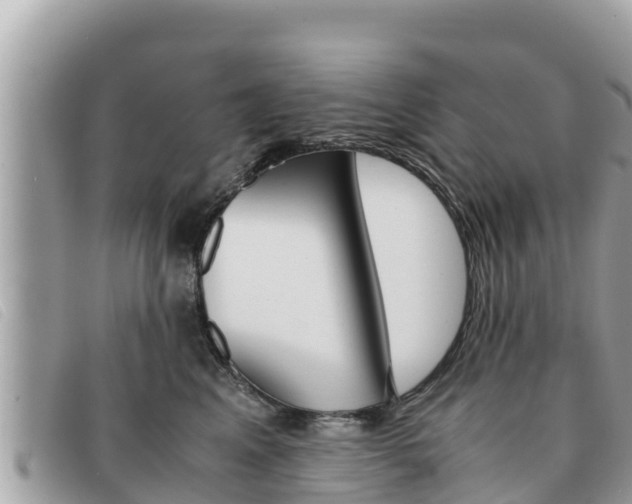 X0000091540617200708171011