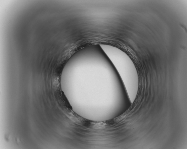 X0000091540621200708171011
