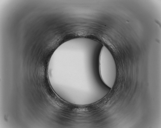 X0000091540639200708171011