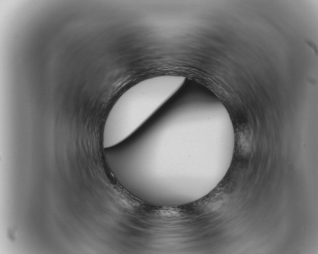 X0000091540668200708171011