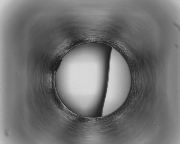 X0000091540696200708171010