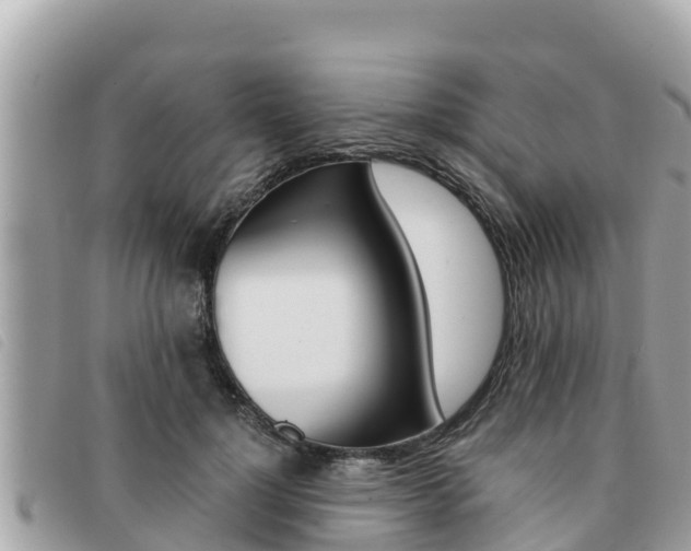 X0000091540748200708171010