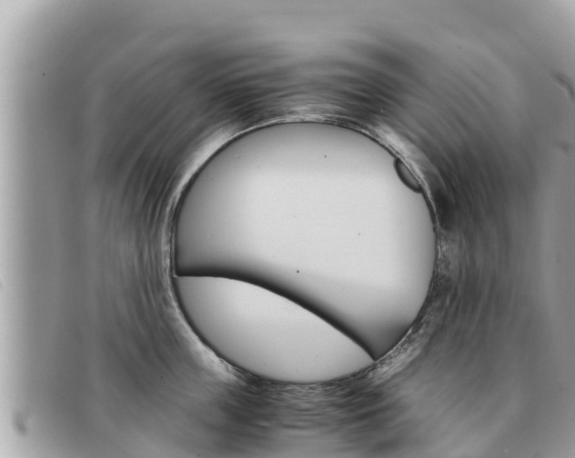 X0000091540859200708171009