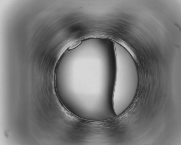 X0000091540861200708171009