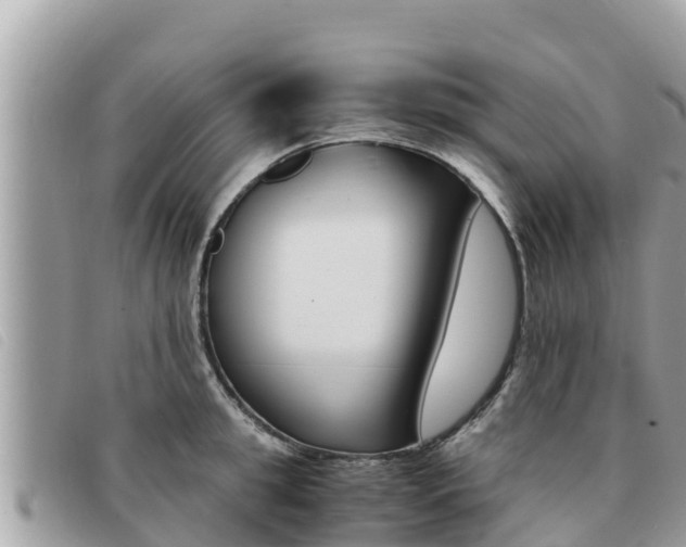 X0000091540949200708171007
