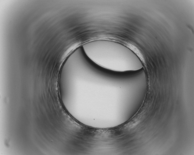 X0000091540954200708171007