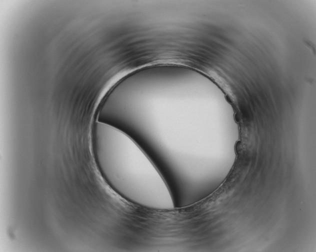 X0000091540955200708171007