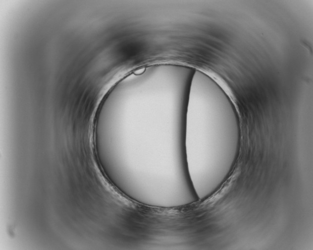 X0000091540957200708171007