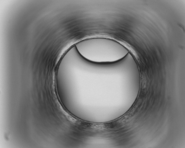 X0000091541006200708171006