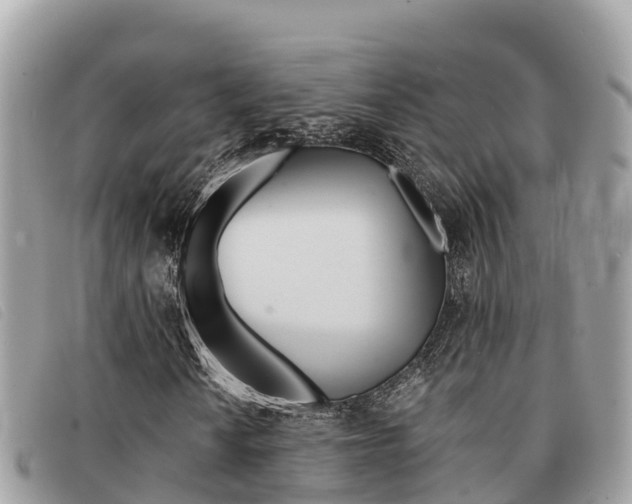 X0000091541010200708171005