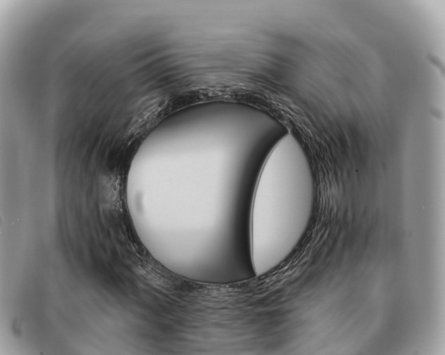 X0000091541060200708171005