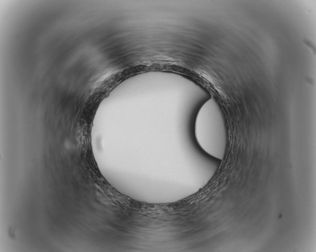 X0000091541063200708171005