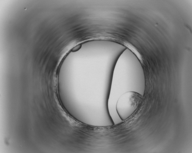 X0000091541099200708171005