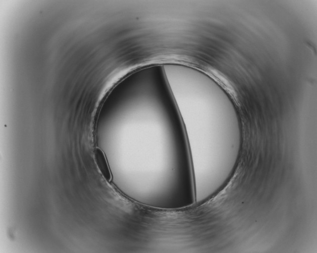 X0000091541192200708171004
