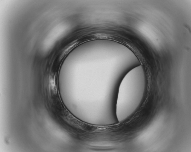 X0000091541198200708171004