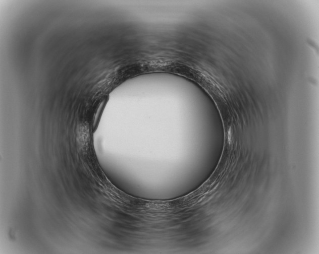 X0000091541299200708171002