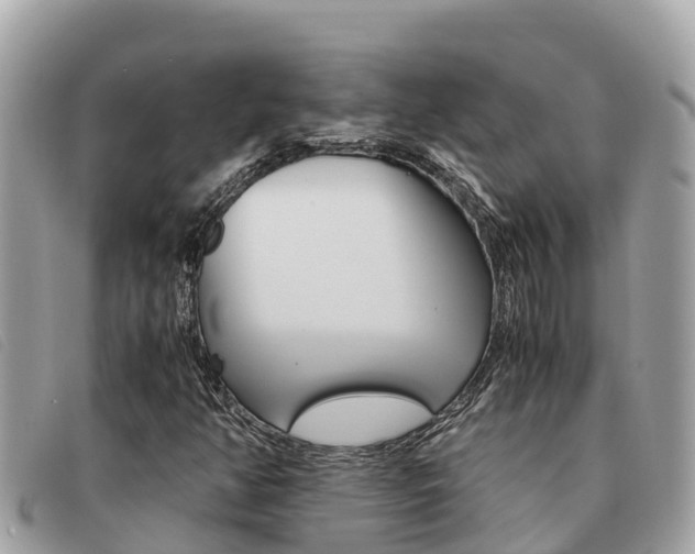 X0000091541350200708171002
