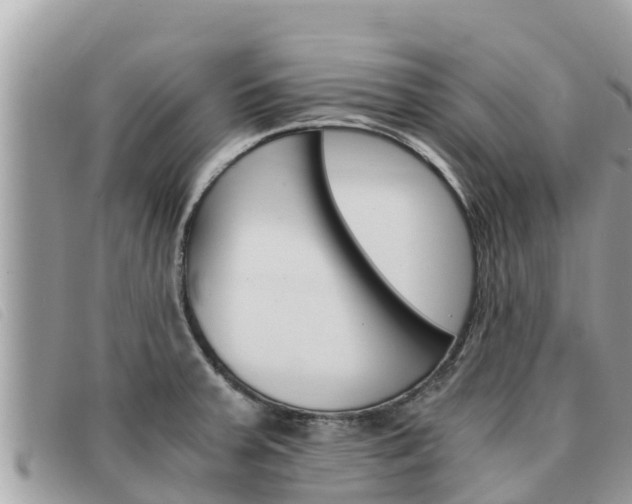 X0000091541379200708171001