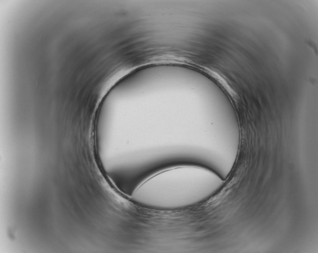 X0000091541387200708171001