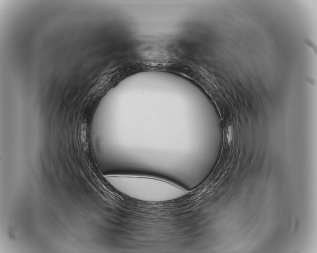 X0000091541396200708171000