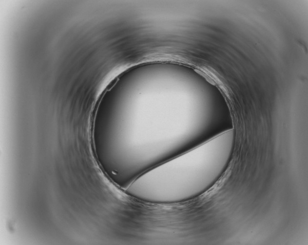 X0000091541438200708171001
