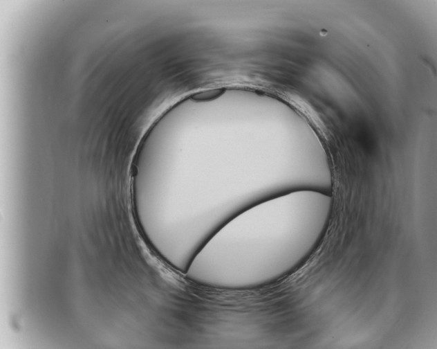 X0000091541439200708171001