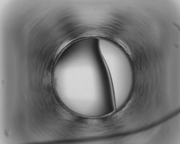 X0000091541465200708171000
